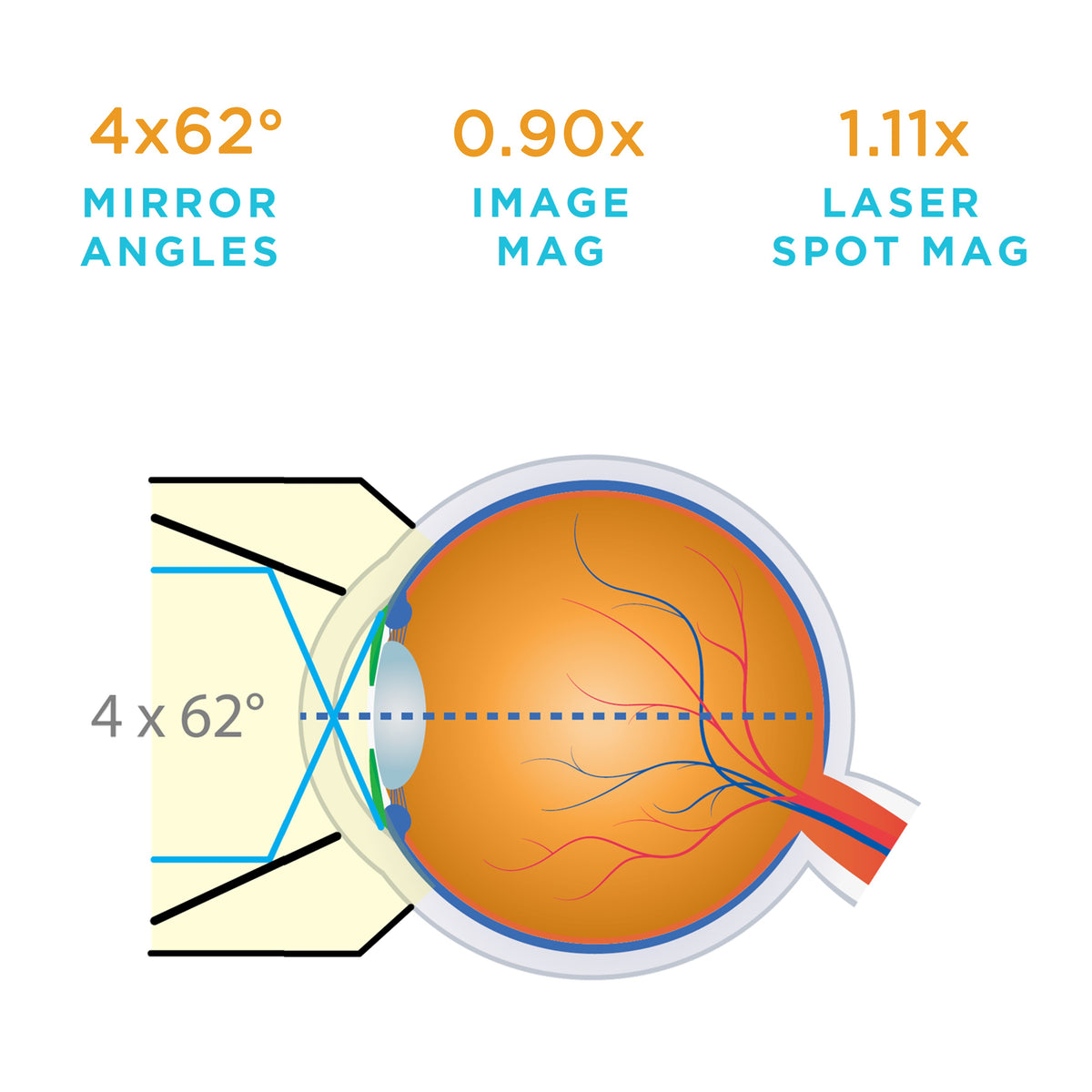 Mini 4-Mirror Lens