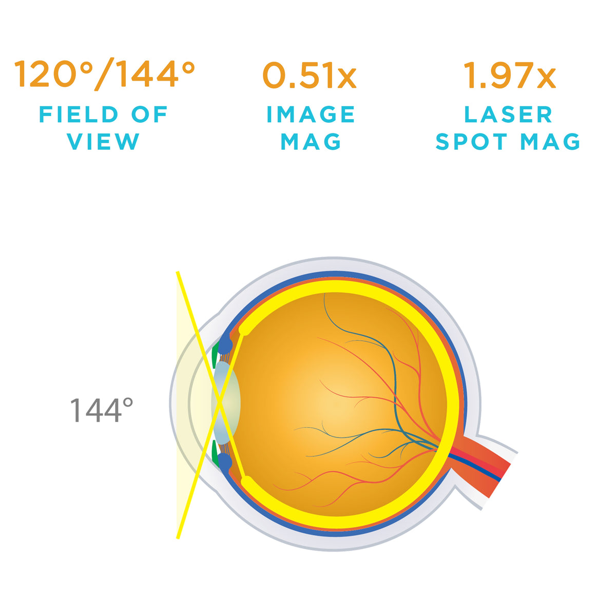 Volk QuadrAspheric® Lens – Volk Optical