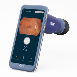 Viva Non-Mydriatic Handheld Retinal Camera